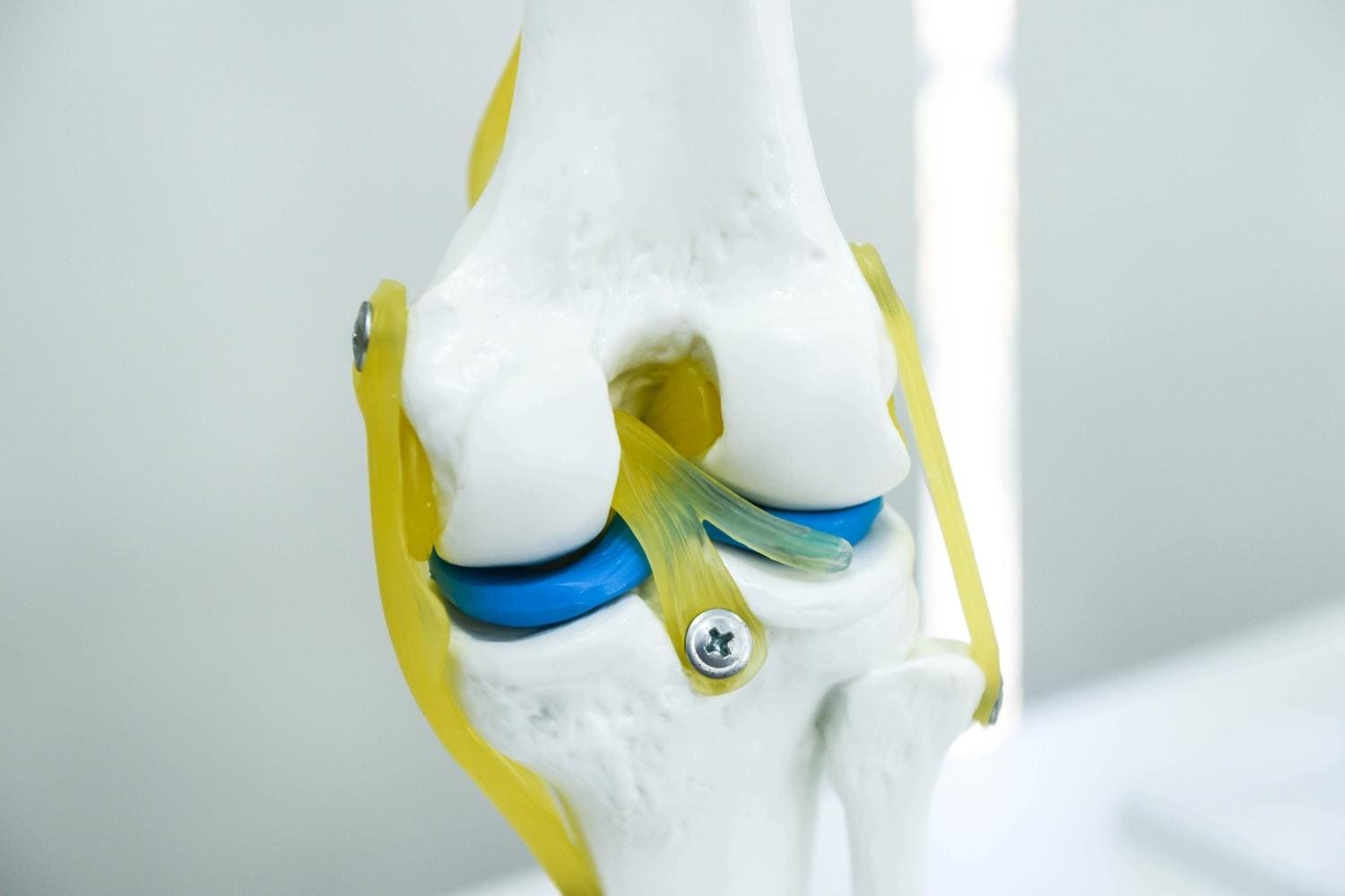Artroscopia de Rodilla En monterrey Dr Arturo Moran