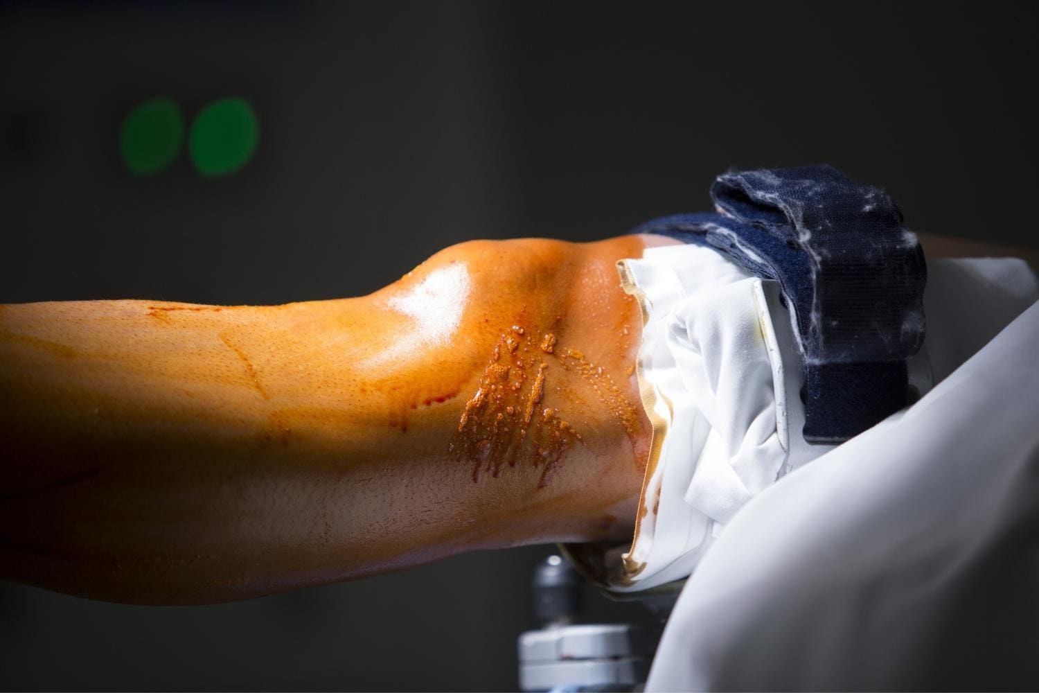Dr Arturo Moran Artroscopia de Rodilla en Monterrey